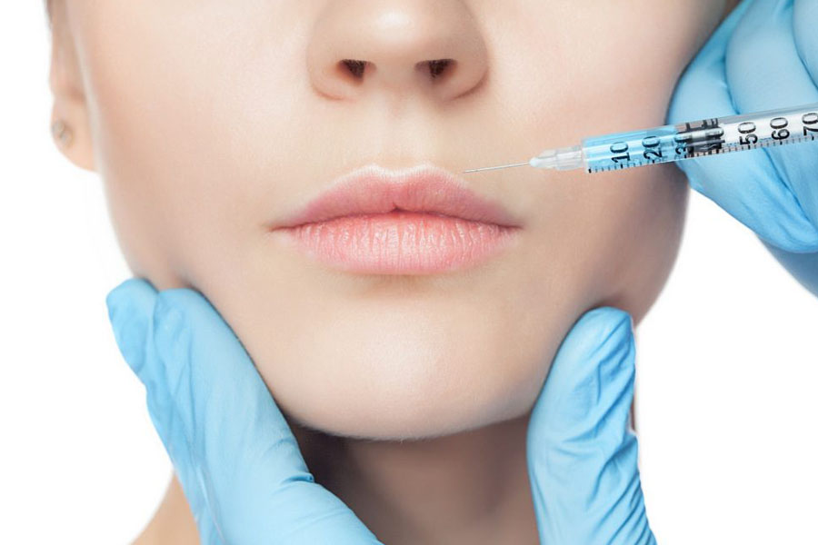 ボトックス治療