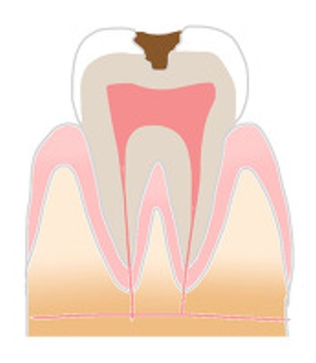 都立大学の歯医者、あさの歯科クリニック