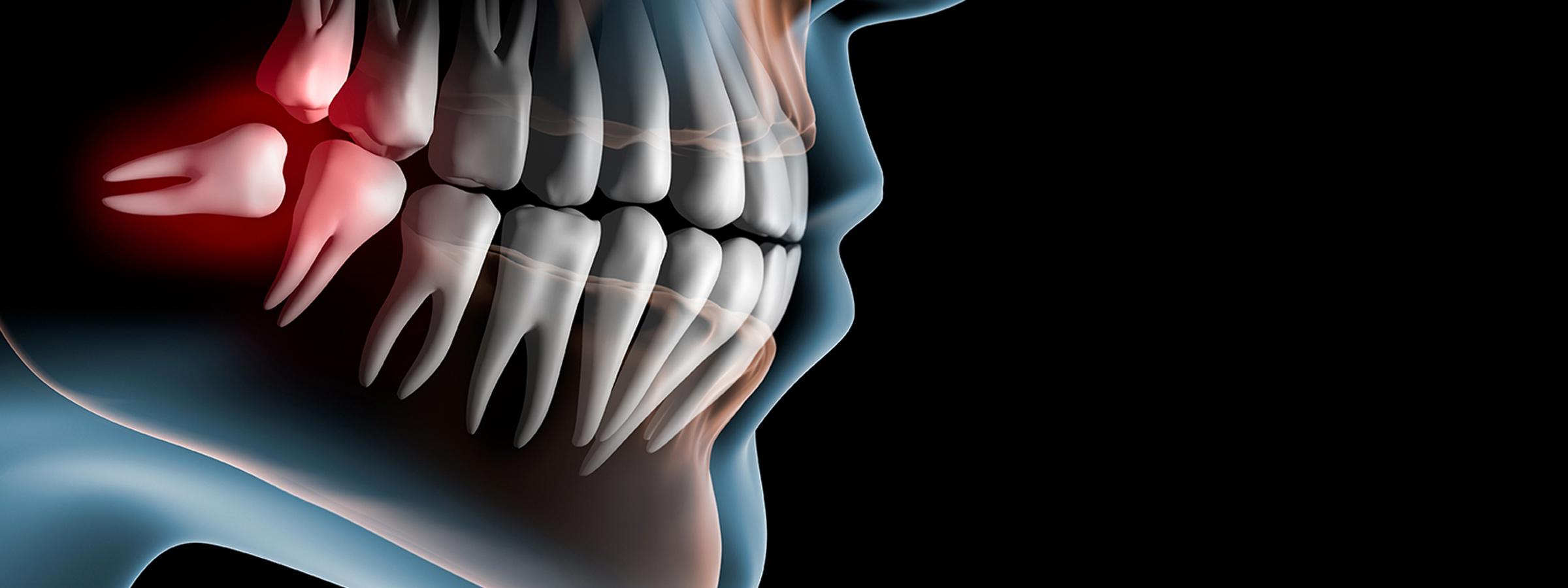 目黒区、都立大学の歯医者、あさの歯科クリニック