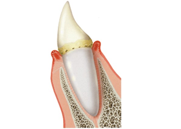 目黒区、都立大学の歯医者、あさの歯科クリニック